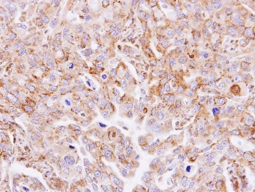 MGAT3 Rabbit Polyclonal Antibody