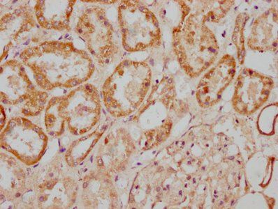 MGAT4B Antibody