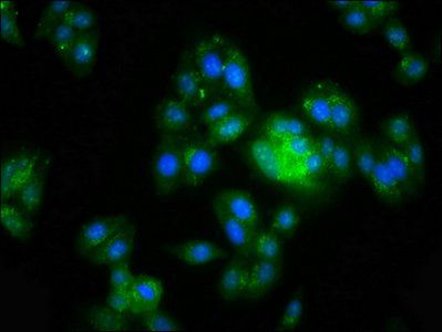 MGAT5 Antibody