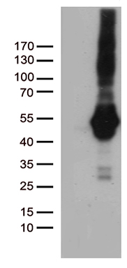MGC13096 (PDCD2L) antibody