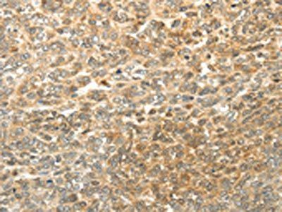 MGEA5 Antibody