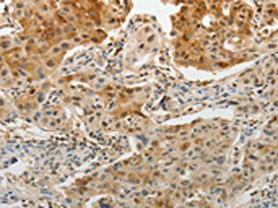 MGEA5 antibody