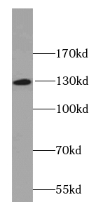 MGEA5 antibody