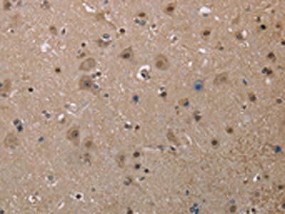 MGLL Antibody