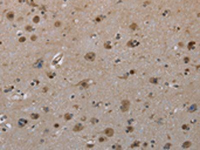 MGLL Antibody