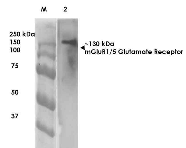 mGluR5 Antibody