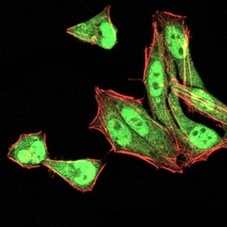 MGMT Antibody