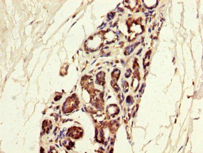 MGP Antibody