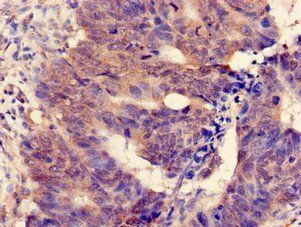 MGST2 Antibody