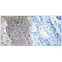 MGST3 Antibody