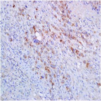 HLA-A Rabbit Polyclonal Antibody