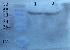 HLA-A Rabbit Polyclonal Antibody