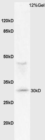 MHC Class II antibody