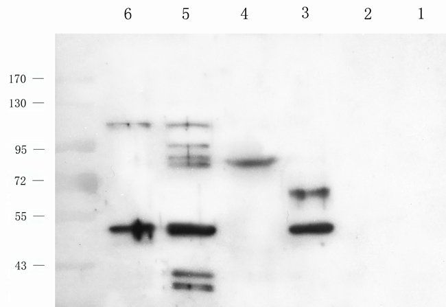 MIB1 antibody