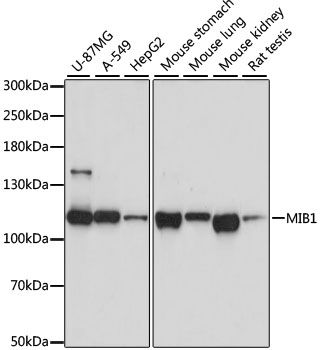 MIB1 antibody