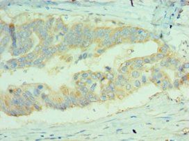 MICA Antibody