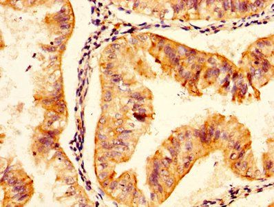 Microfibrillar-associated protein 5 antibody