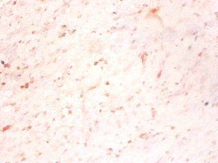 MAP1S Antibody