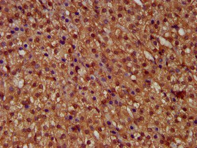 MICU1 Antibody