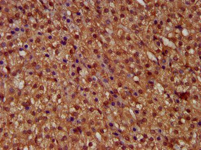 MICU1 antibody