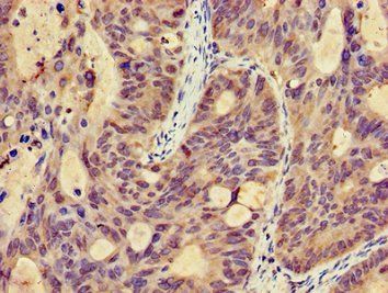 MICU2 Antibody