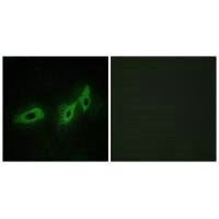 MID1 Antibody