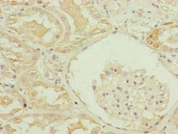 MID2 Antibody