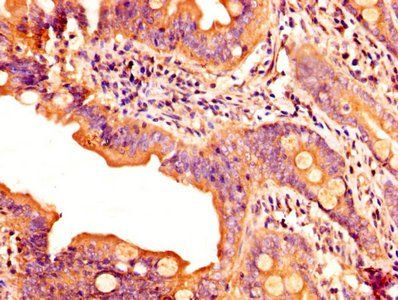 MDK Antibody