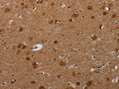 MIG7 Antibody