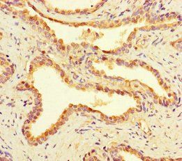 RIOX2 Antibody