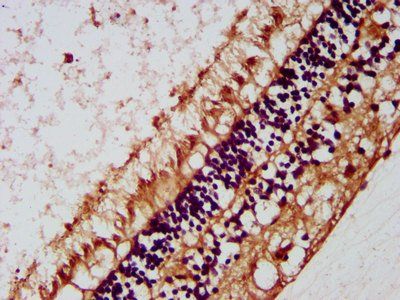 MIP Antibody