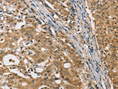 MIP Antibody
