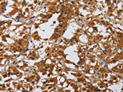 MIP Antibody