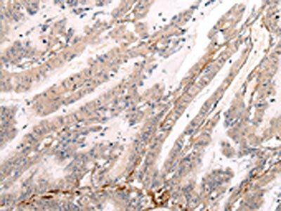 MIP Antibody