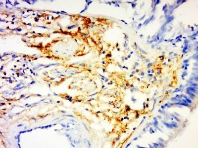 CCL4 Rabbit Polyclonal Antibody