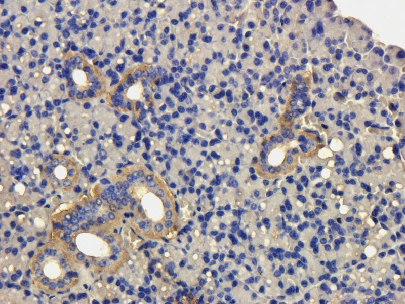 MIP3 beta antibody