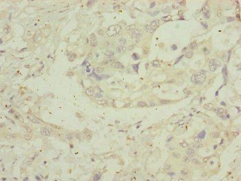 MIPEP Antibody