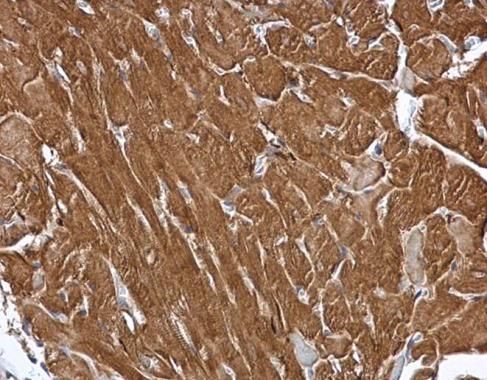 MIPP Rabbit Polyclonal Antibody