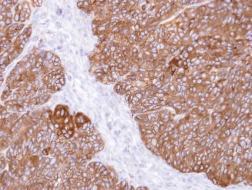 MIPP Rabbit Polyclonal Antibody