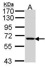 MIPP Rabbit Polyclonal Antibody