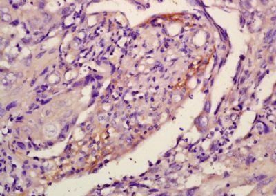 Dyrk1B Rabbit Polyclonal Antibody