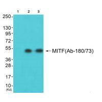 MITF (Ab-180/73) Antibody