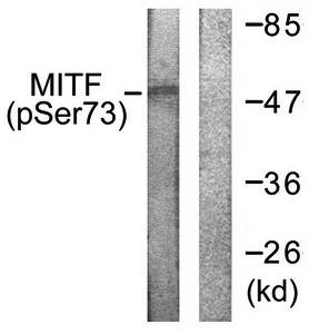 MITF (phospho-Ser180/73) antibody