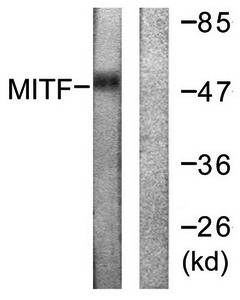 MITF (Ab-180/73) Antibody