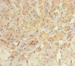 UCP1 Antibody