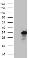 Mitocondrial Translational Initiation Factor 3 (MTIF3) antibody