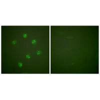 MKI67 Antibody
