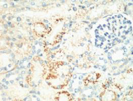 MKI67 Monoclonal Antibody