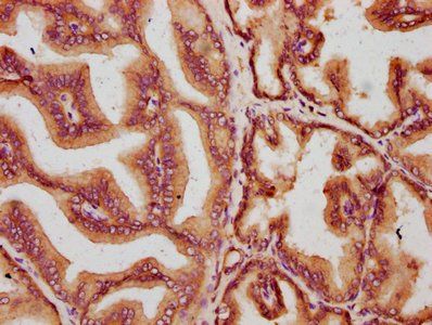MKLN1 Antibody