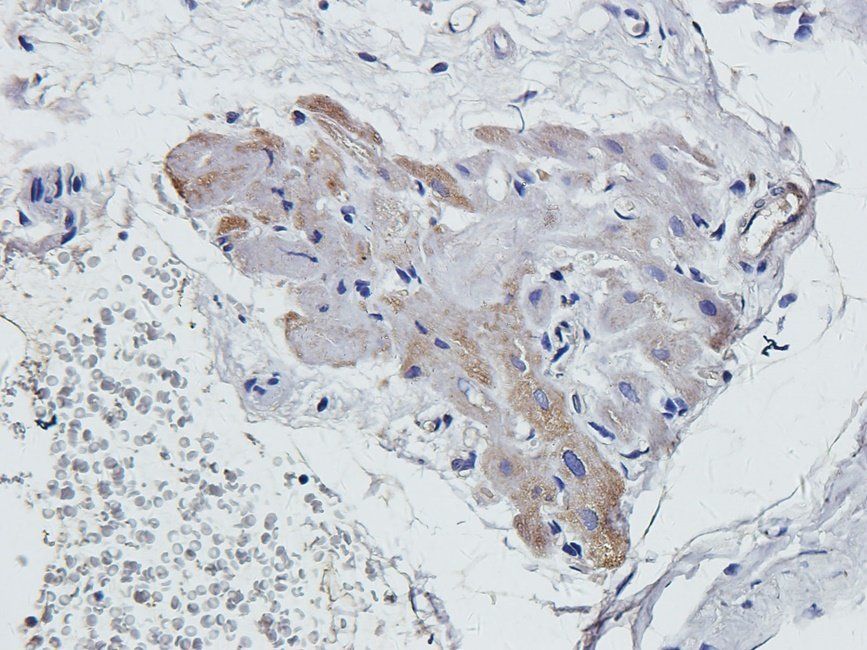 MKLP1 antibody